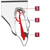 Endodontie Wurzelbehandlung 1