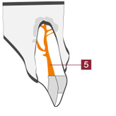 Endodontie Wurzelbehandlung 3